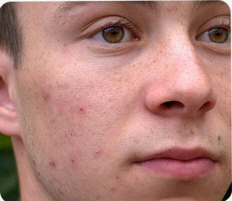 Before treatment photo