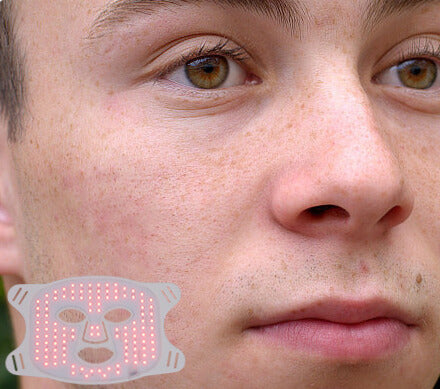 After treatment photo